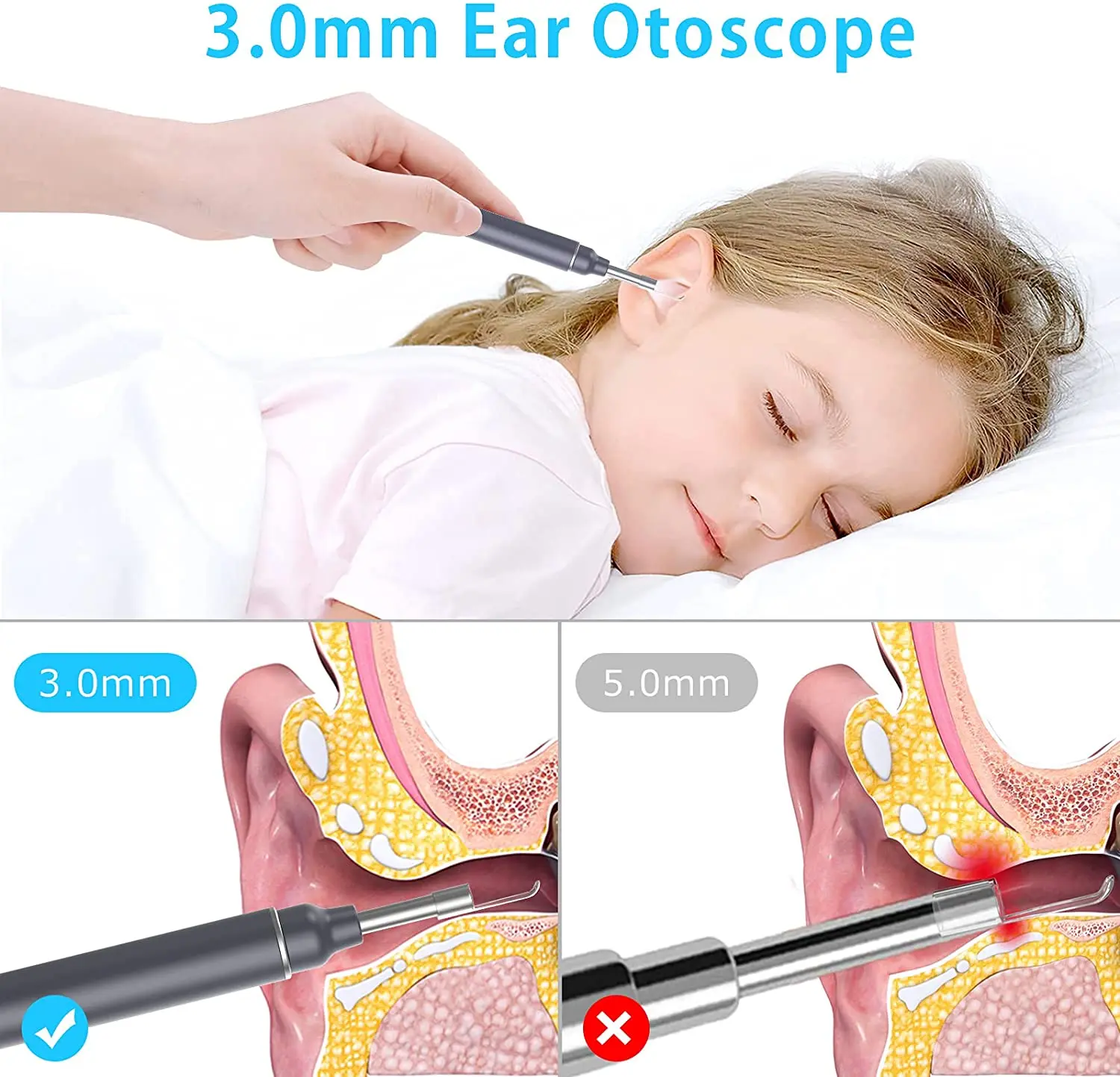 VITCOCO 검이경 귀 왁스 제거 비주얼 파기 귀 스푼, 초박형 검이경, 와이파이 HD 무선 귀 피킹 미러 내시경, 3.0mm